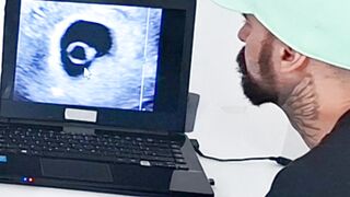 Wife does ultrasound with naughty doctor next to cuckold husband