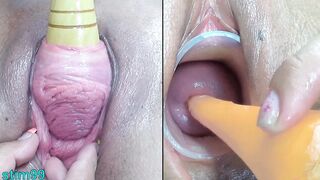 Mature Lesbians Pee hole Insertion and Cervix Fucking one to other Uncensored urethral sounding